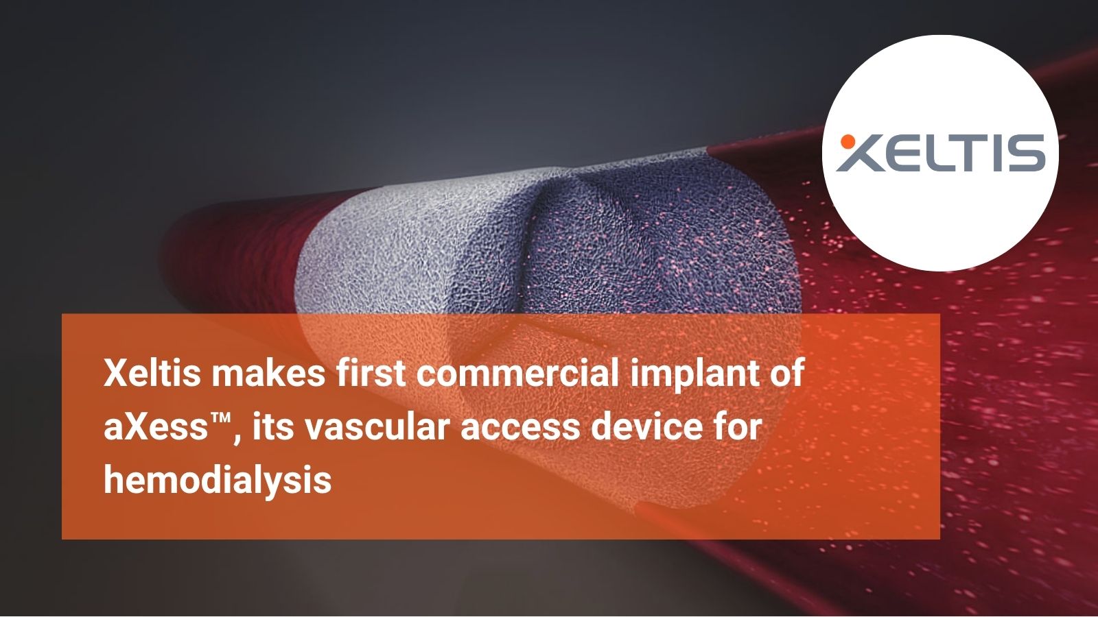 Xeltis makes first commercial implant of aXess™, its vascular access device for hemodialysis<